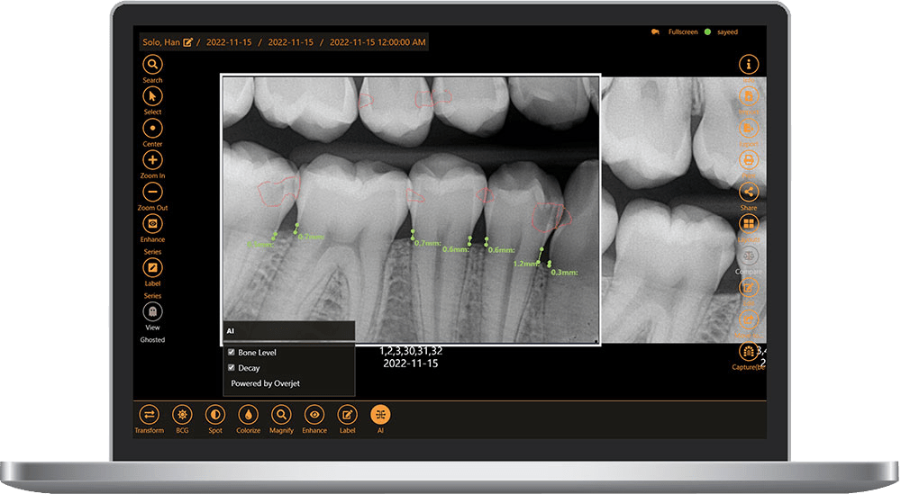 Apteryx XVWeb | Advanced Dental Imaging Software by Planet DDS